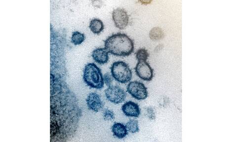 Γουινέα - Συναγερμός στον ΠΟΥ: Καταγράφηκε το πρώτο κρούσμα του μολυσματικού ιού Μάρμπουργκ