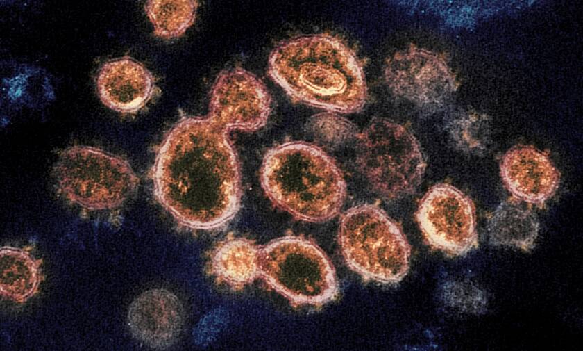 Σωματίδια του ιού SARS-CoV-2  