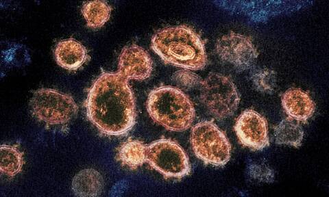 Τα σωματίδια του ιού SARS-CoV-2, που προκαλούν COVID-19