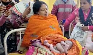 Ινδία: Γεννήθηκε μωρό με τέσσερα χέρια και τέσσερα πόδια - Σκληρές εικόνες