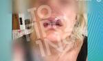 Εικόνες σοκ: 38χρονη καταγγέλλει γνωστό πλαστικό χειρουργό
