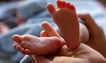 Ινδία: Μωρό γεννήθηκε με δύο κεφάλια, τρία χέρια και δύο καρδιές