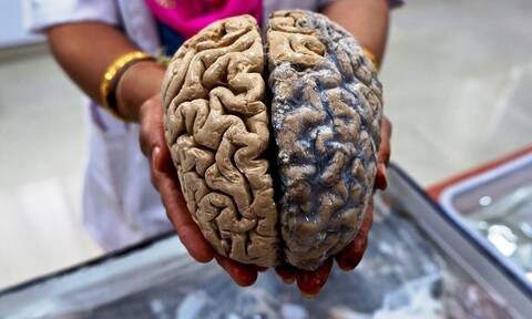 Ανθρώπινος εγκέφαλος: Πόσο ζυγίζει τελικά;