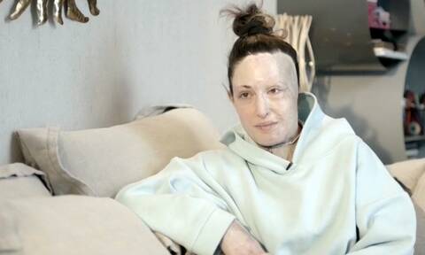 Ιωάννα Παλαιοσπύρου: Έβγαλε τη μάσκα και συγκλόνισε με τη δύναμή της
