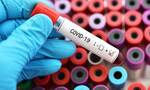 Κορονοϊός: Το νέο τεστ ELISA ανιχνεύει αντισώματα covid στα ούρα