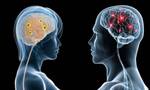 Έρευνα: Υπάρχει τελικά διαφορά ανάμεσα στον ανδρικό και τον γυναικείο εγκέφαλο;