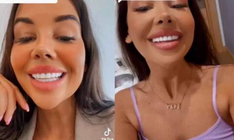 TikTok: Influencer ξόδεψε 3.500 λίρες για τα δόντια της και τώρα κινδυνεύει