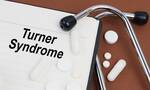 Σύνδρομο Turner: Η γενετική βάση, η διάγνωση και η αντιμετώπισή του