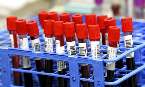 Επιστήμονες «έφτιαξαν» αίμα από βλαστοκύτταρα - Ξεκινά κλινική δοκιμή