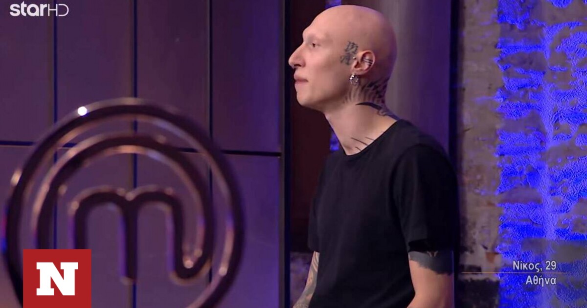 MasterChef: Passionate gamer with alopecia – ‘I woke up with half my hair on the bed’